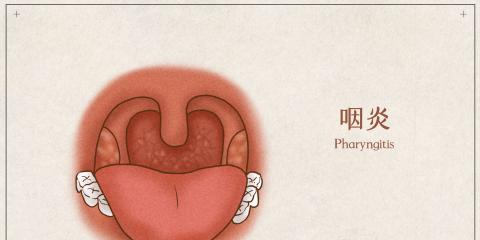 藥膳養(yǎng)出好喉嚨，中醫(yī)教你慢性咽炎食療方