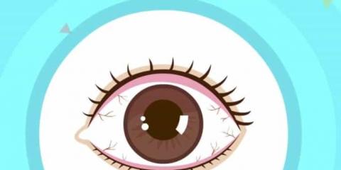 中醫(yī)治干眼：方法多樣，標本兼治